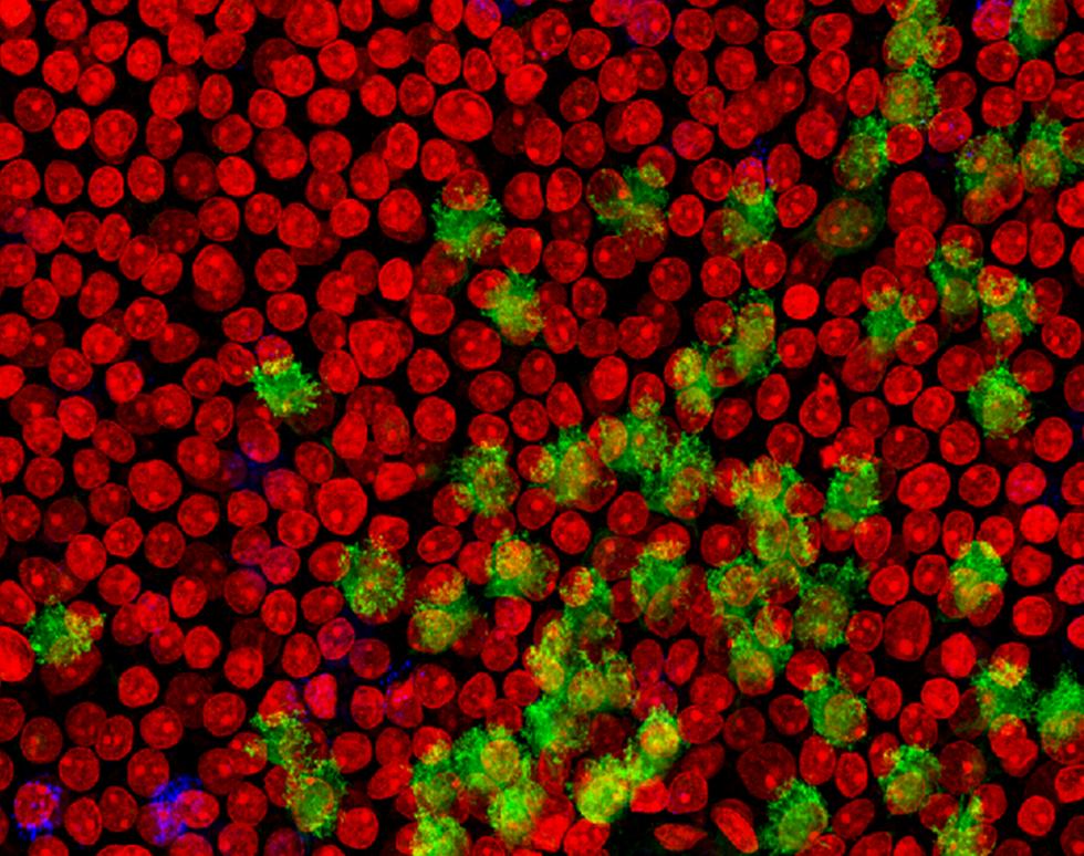 Ciliated airway epithelial cells